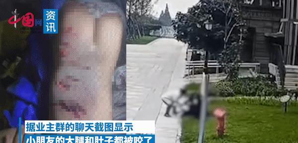 女子遭大型犬撕咬事件，司机鸣笛应对引发社会反思与行动